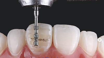 Dentistas virtuais: startup capta R$ 600 mil para ampliar odontologia digital